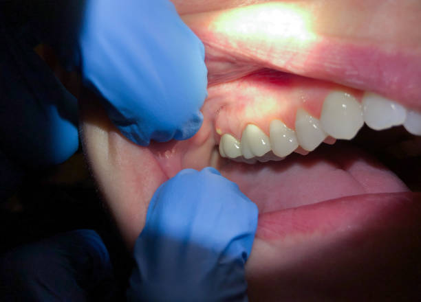 Best Orthodontic Emergency Dentist in St Albans, VT
