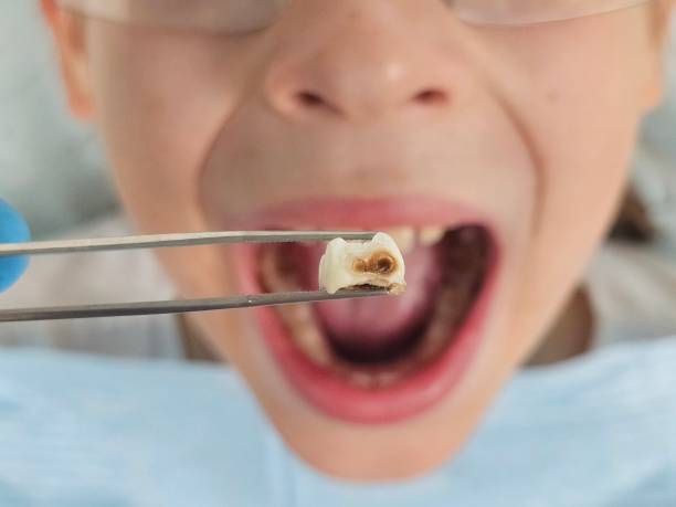 Best Urgent Dental Care for Toothache in St Albans, VT